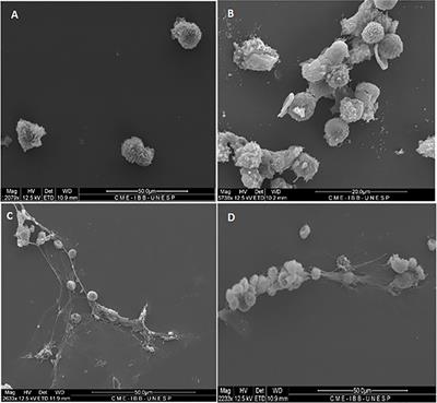 Paracoccidioides brasiliensis Releases a DNase-Like Protein That Degrades NETs and Allows for Fungal Escape